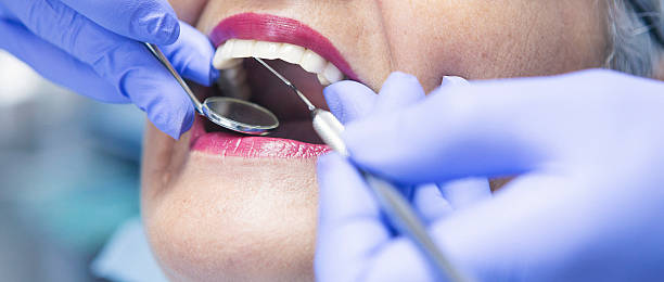 Best Emergency Root Canal Treatment in East Highland Park, VA